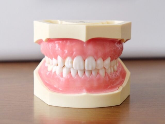 しかのデンタルクリニック入れ歯の治療